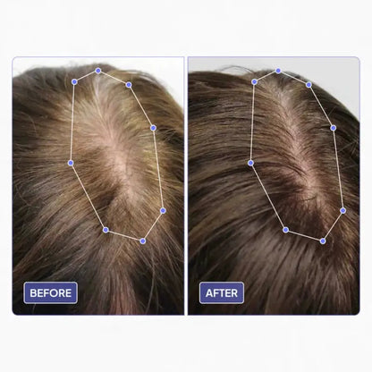 Scalp Hair Growth Oil
